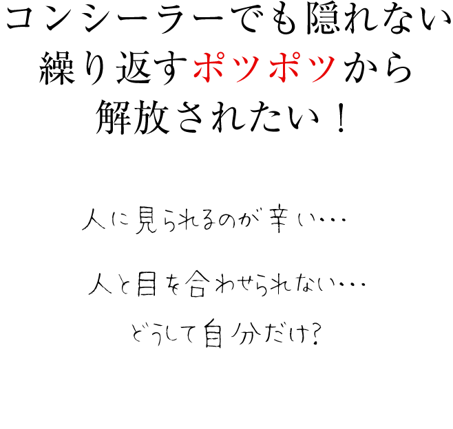コンシーラーでも隠し切れない
